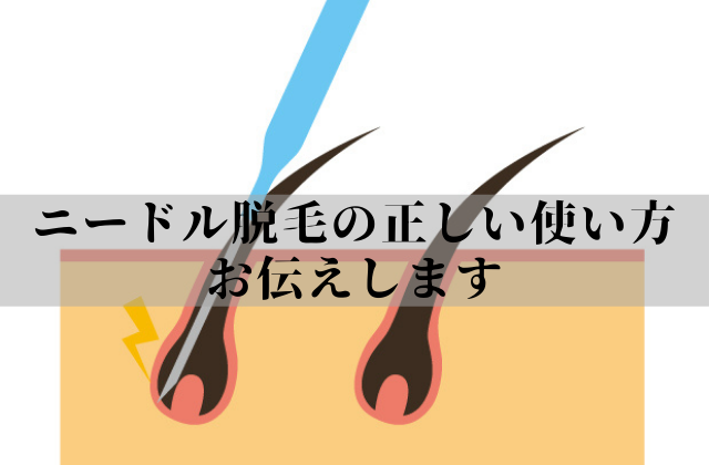 【もう１つの永久脱毛？】ニードル脱毛の真実を全公開