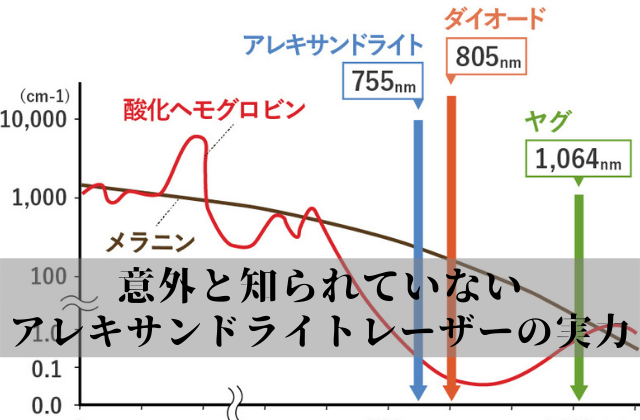 【脱毛知識】アレキサンドライトレーザーの実力は？特徴と注意点を徹底解説